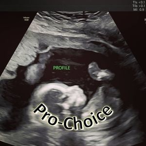 Meet your Posher, Terra